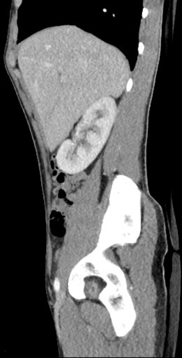 Schwarzer und weißer MRI-Scan eines Kniegelenks, der detaillierte Anatomie zeigt.